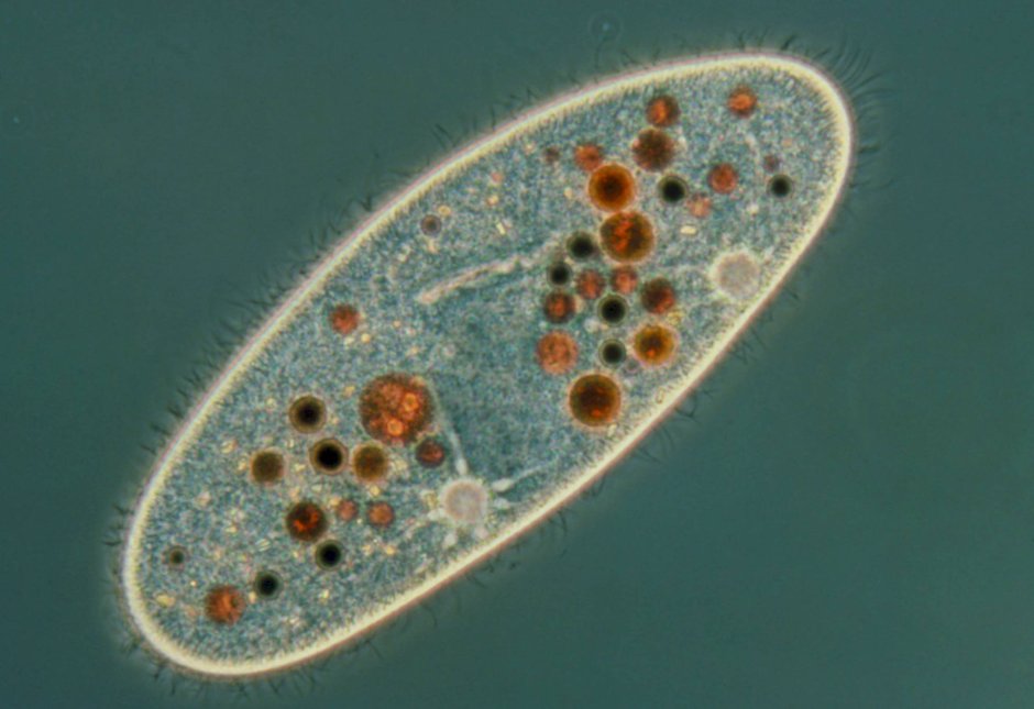 Микро клеток. Инфузория туфелька в микроскопе. Инфузория туфелька под микроскопом. Инфузория Бурсария. Инфузории (vorticellacovallaria).