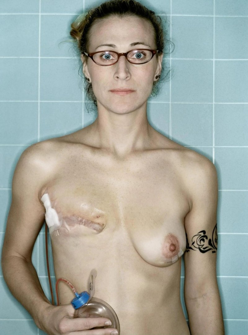 Ugly breasts