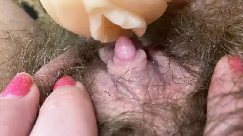 Genital organ