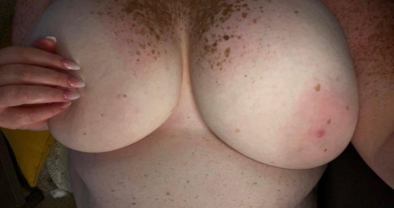 Woman with freckles