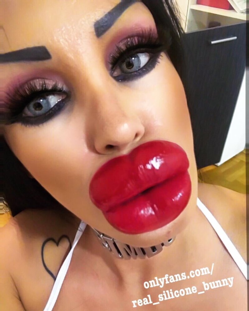 Huge lips