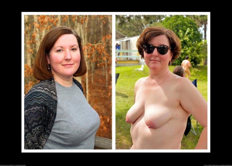 Breast enlargement