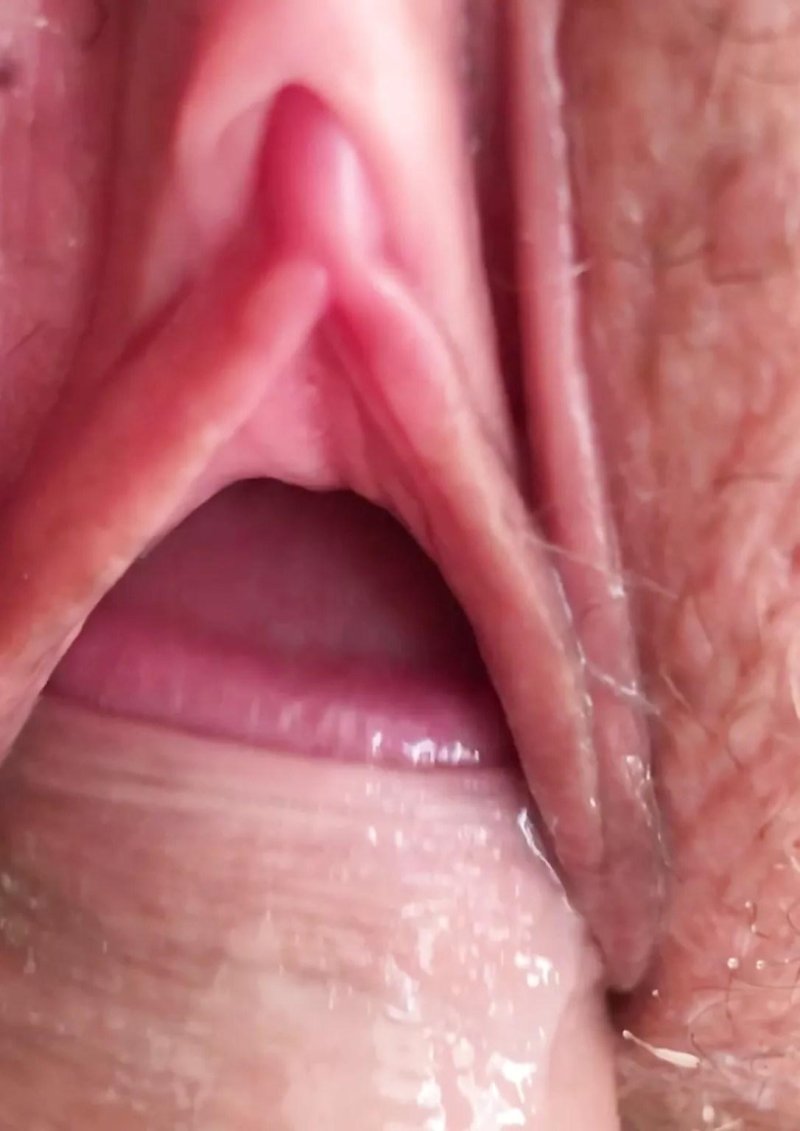 Inside the vagina is large