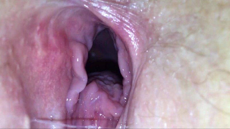 Vagina view from the inside