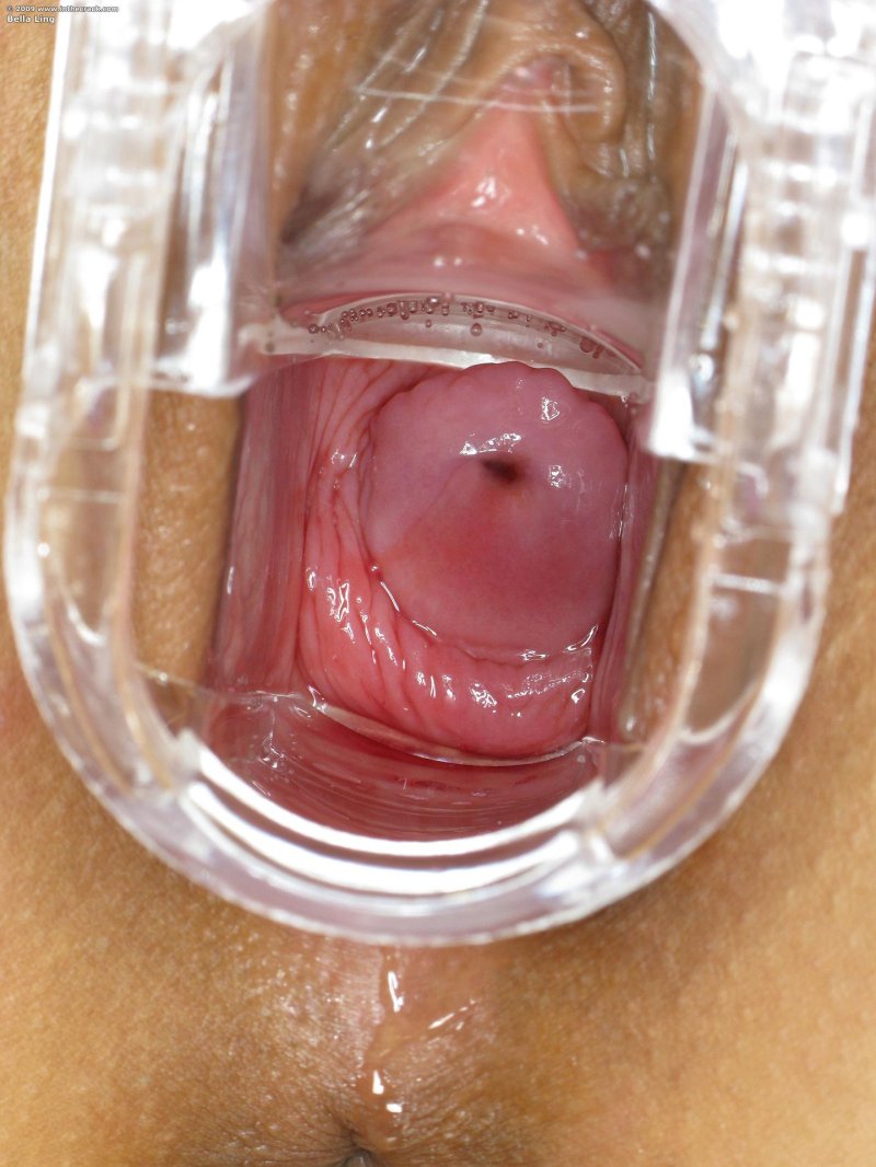 Vagina close -up from the inside