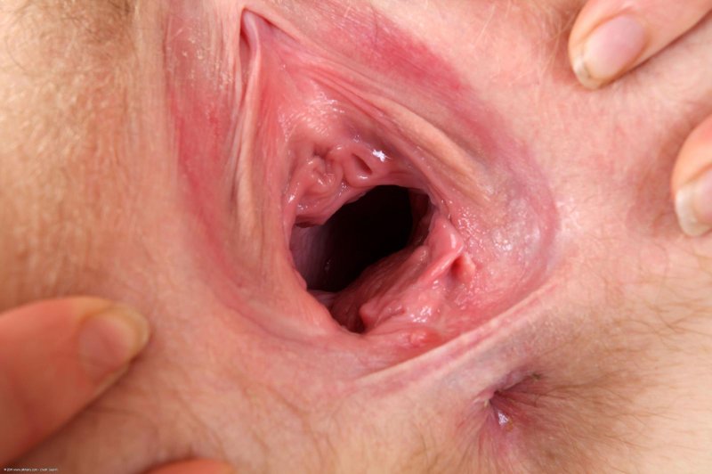 Opened vagina close -up