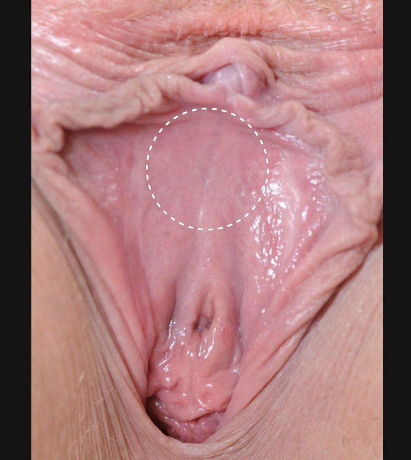 Healthy vagina