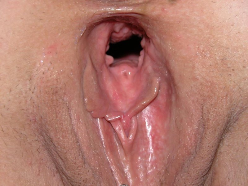 Close -up vagina