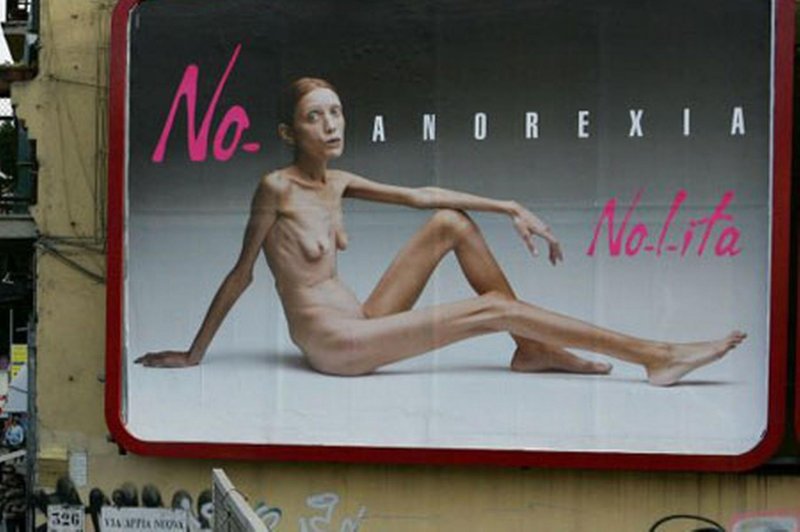 Anorexic girl