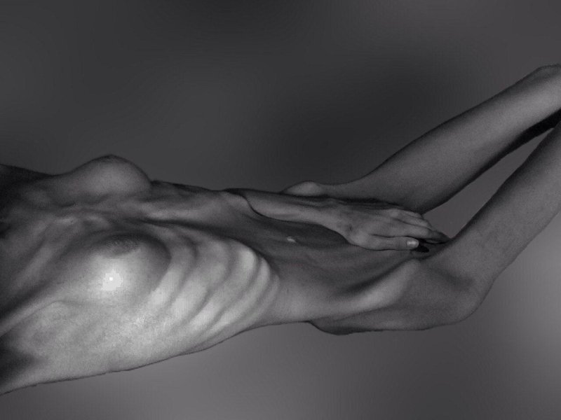 Anorexia nude