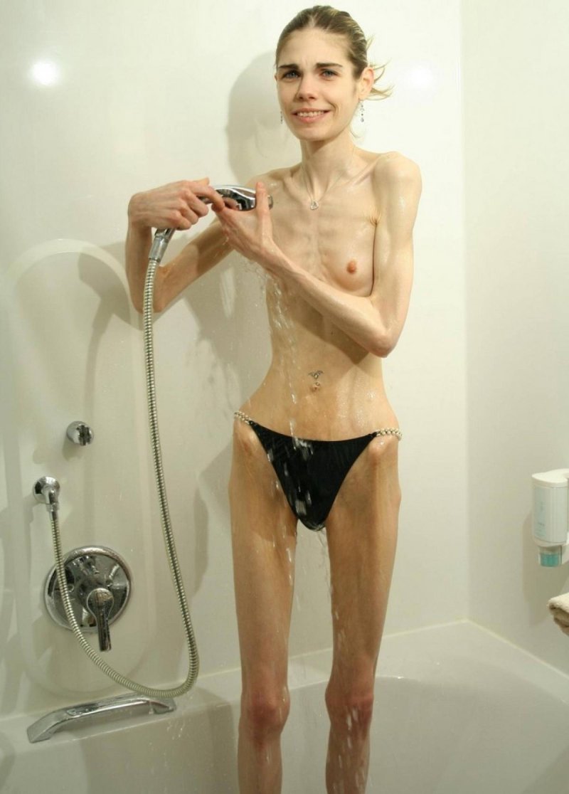 Completely naked anorexica