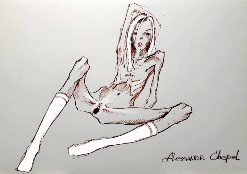 Alexander Chepel anorexia