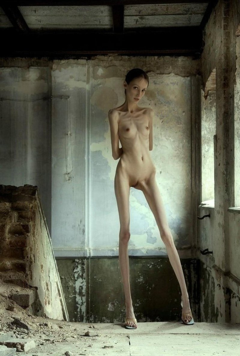 Naked anorexic women