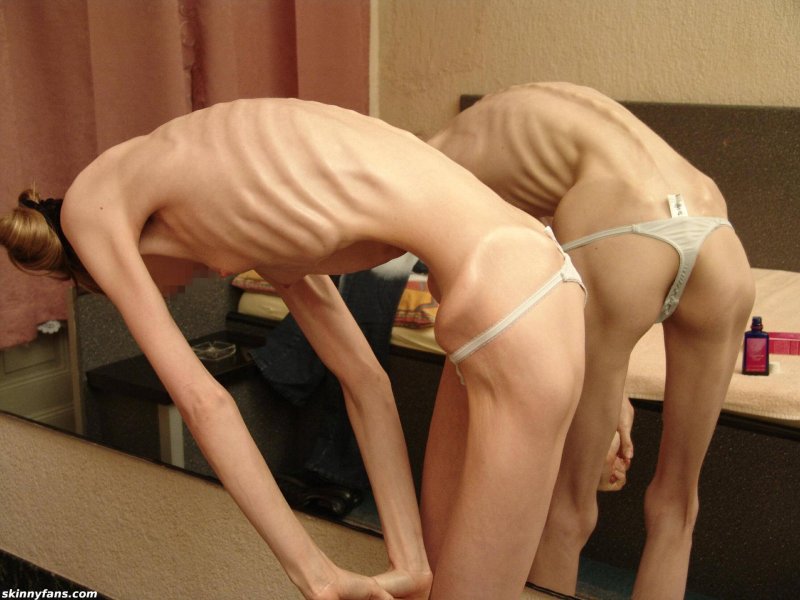 Porn anorexics