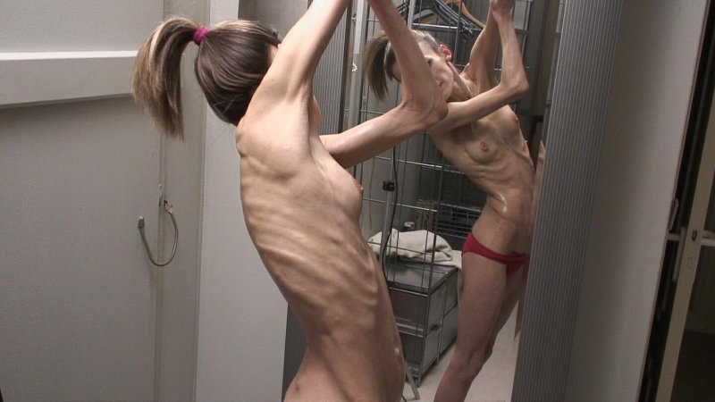 Naked anorexici bdsm