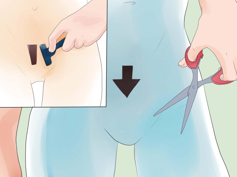Proper shaving of the bikini zone