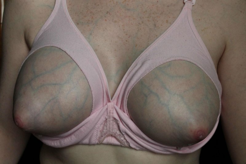 Natural breasts with veins