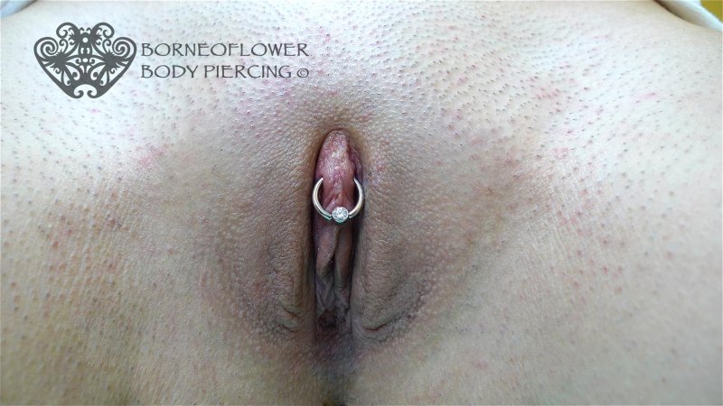 Piercing Puncture of the Klitor Klitorsk