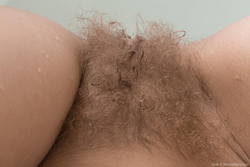 Convex hairy pubis