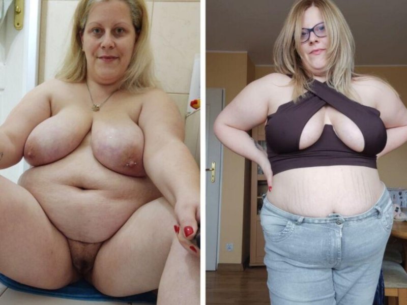 Weight loss