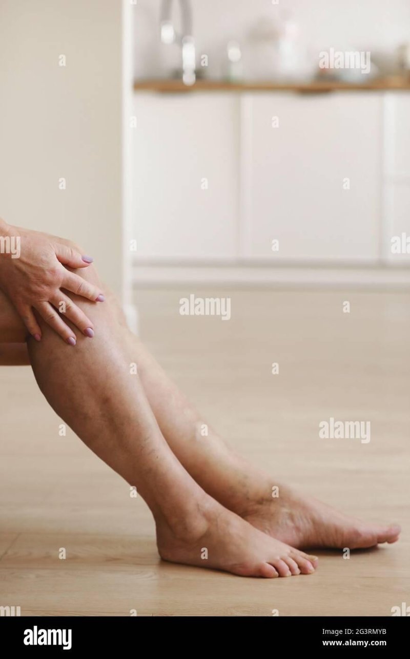 Active legs