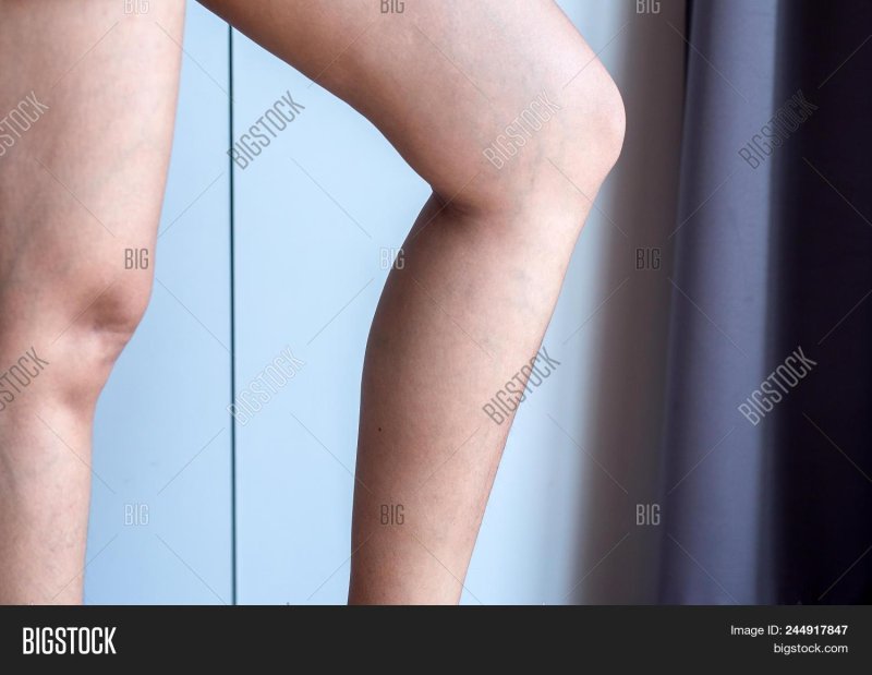 Visible veins on the legs