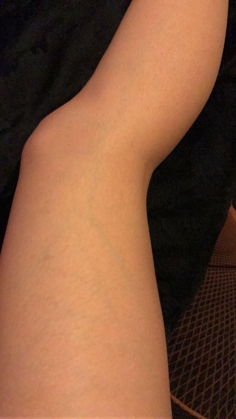 You can see the veins on legs