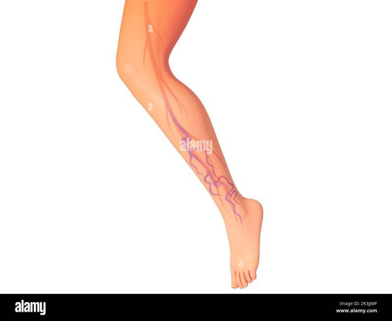 Varicose veins treatment