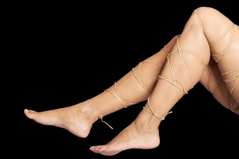 Related legs