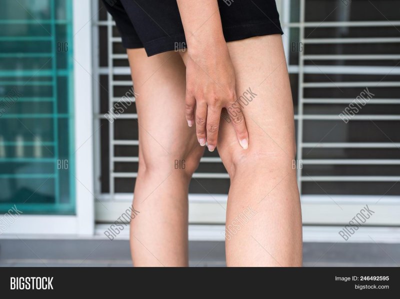 Vienna on the legs