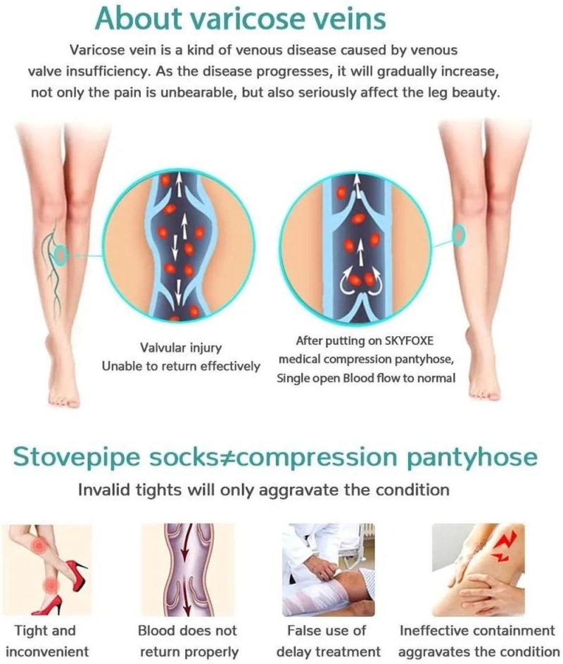 From varicose veins