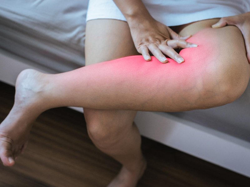 Polyarthrosis of the joints